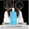 Unisex Protein Anti Dandruff Conditioner (350 ML)