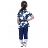 Girl's Denim Tie & Dye Short Sleeve Top (Blue-White) Girl's Denim Tie & Dye Short Sleeve Top (Blue-White)